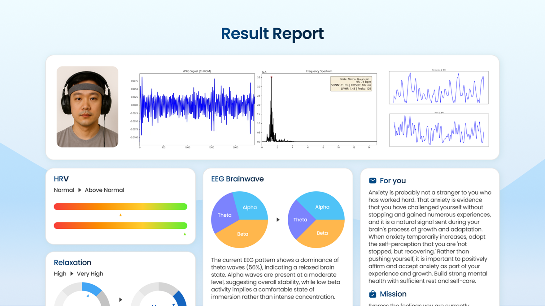 MINDENNA DESK result report showing HRV, EEG brainwave balance and relaxation, before and after